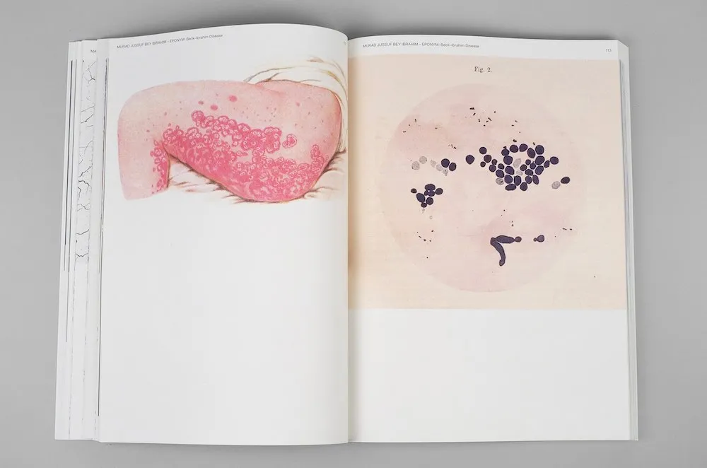 Image of Piero Martinello and Piero Casentini – The Weight of the Word
